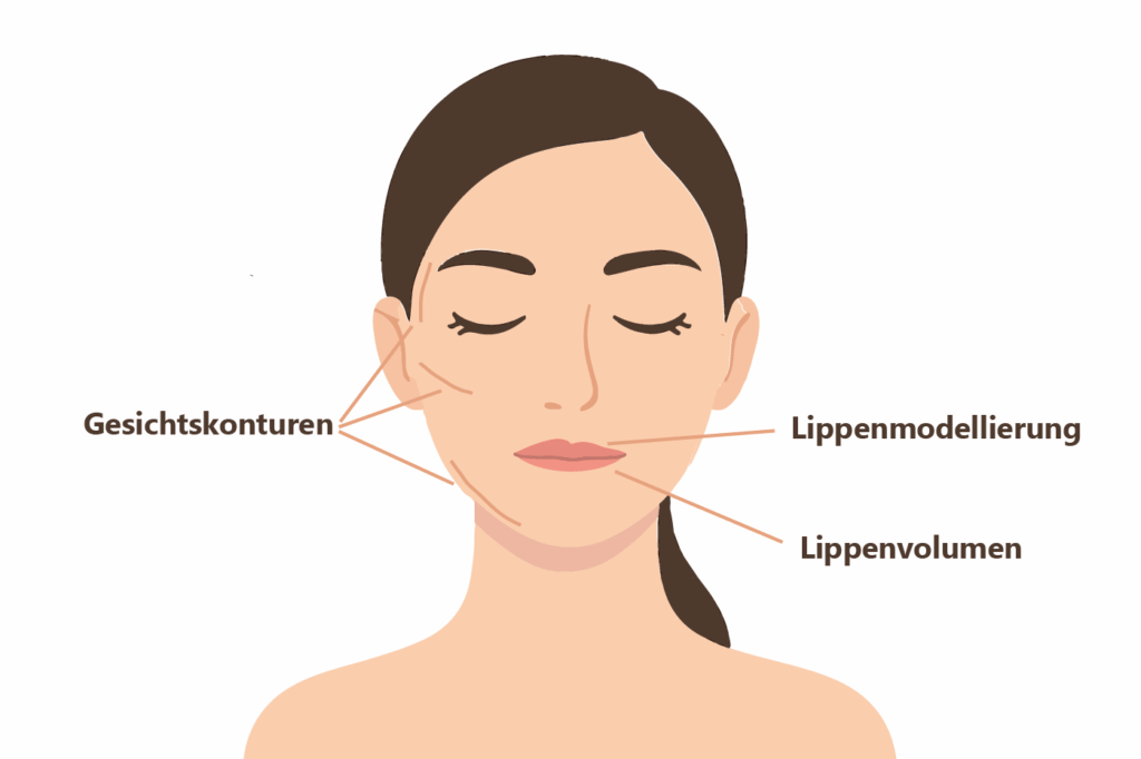 Vorschaubild zu Indikationen bei Lippenmodellierung und Volumenaufbau im Gesicht